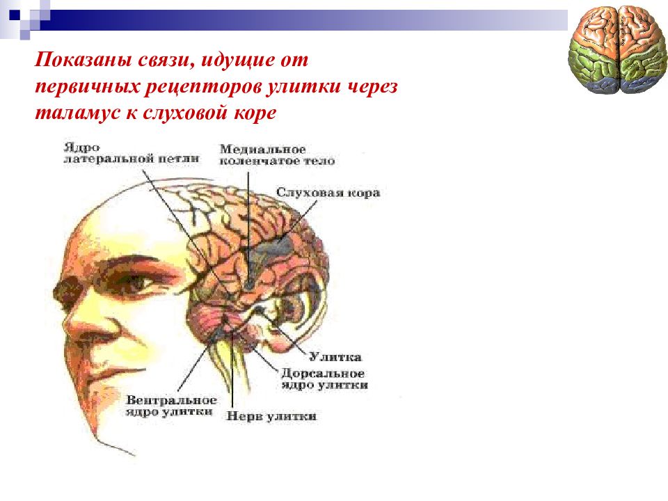 Сенсорные слуховые расстройства презентация