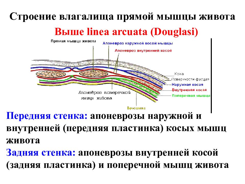 Поперечный распил передней брюшной стенки выше и ниже пупка схема