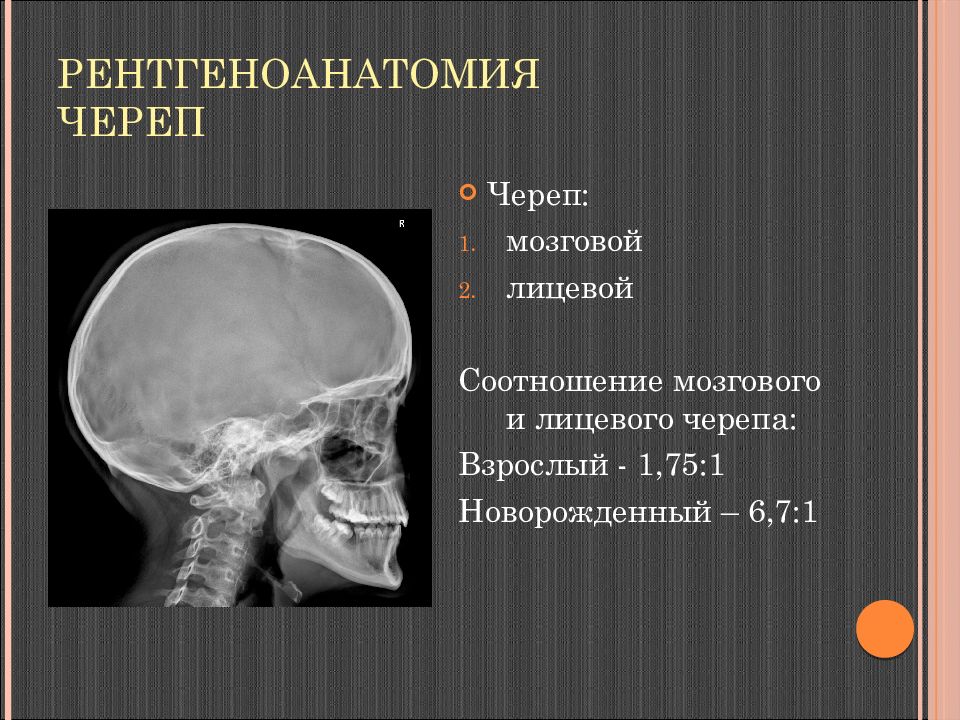 Соотношение мозгового и лицевого черепа. Кости черепа рентген норма. Кости черепа рентген анатомия. Рентгеноанатомия черепа. Череп рентген анатомия.