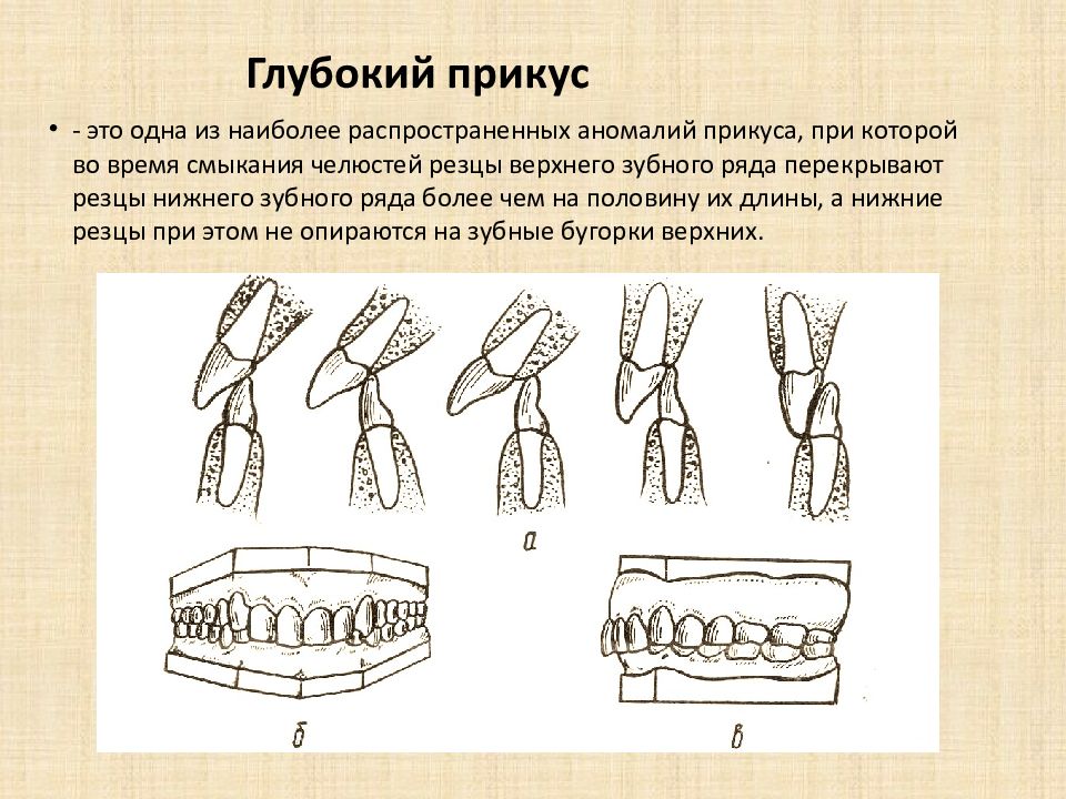 Биомеханика нижней челюсти презентация