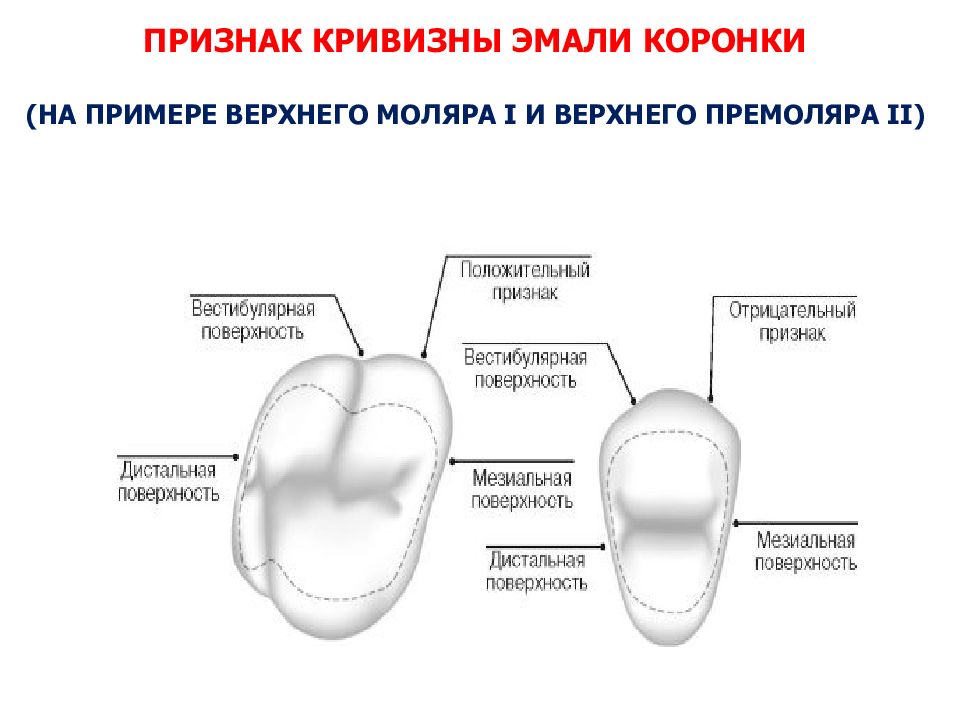 Признаки верхнего. Обратный признак кривизны коронки верхнего первого премоляра. Признак кривизны эмали. Апроксимальная поверхность коронки зуба. Признак кривизны эмали коронки.