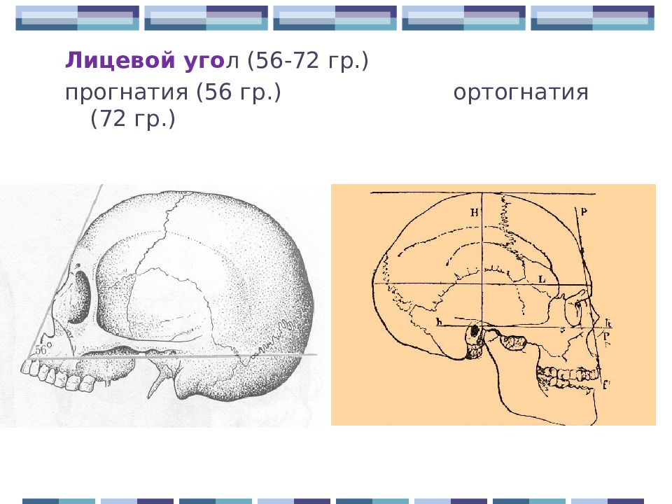 Prognathia латынь. Лицевой угол. Лицевой угол черепа. Лицевой угол анатомия. Лицевой угол черепа анатомия.