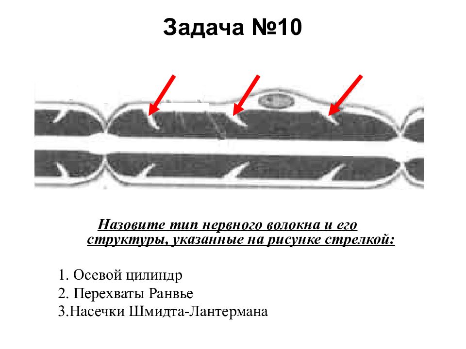 На рисунке ниже показано строение миелинизированного нервного волокна