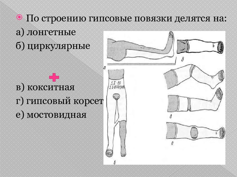 Гипсовые повязки презентация