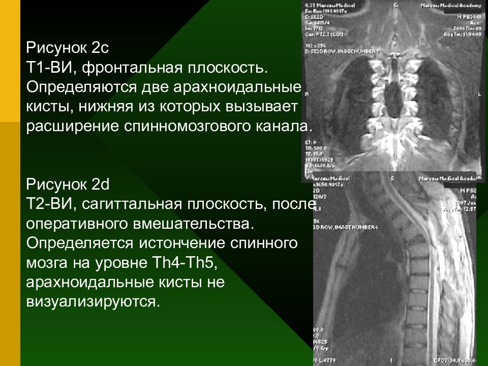 Лучевая диагностика позвоночник презентация