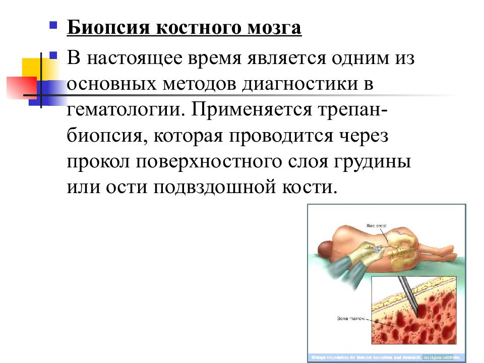 Как происходит забор костного мозга. Трепанобиопсия костного мозга. Анализ пункции костного мозга. Пункционная биопсия костного мозга.