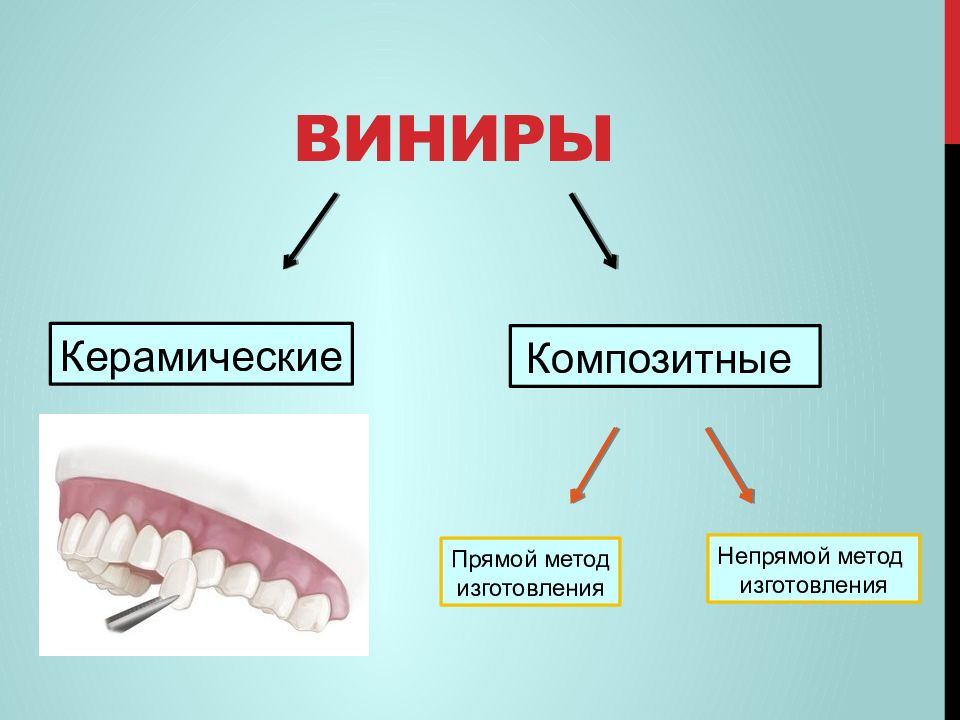 Виниры на зубы картинки