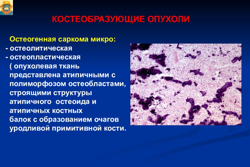 Опухоли опухолеподобные поражения и кисты кожи лица презентация