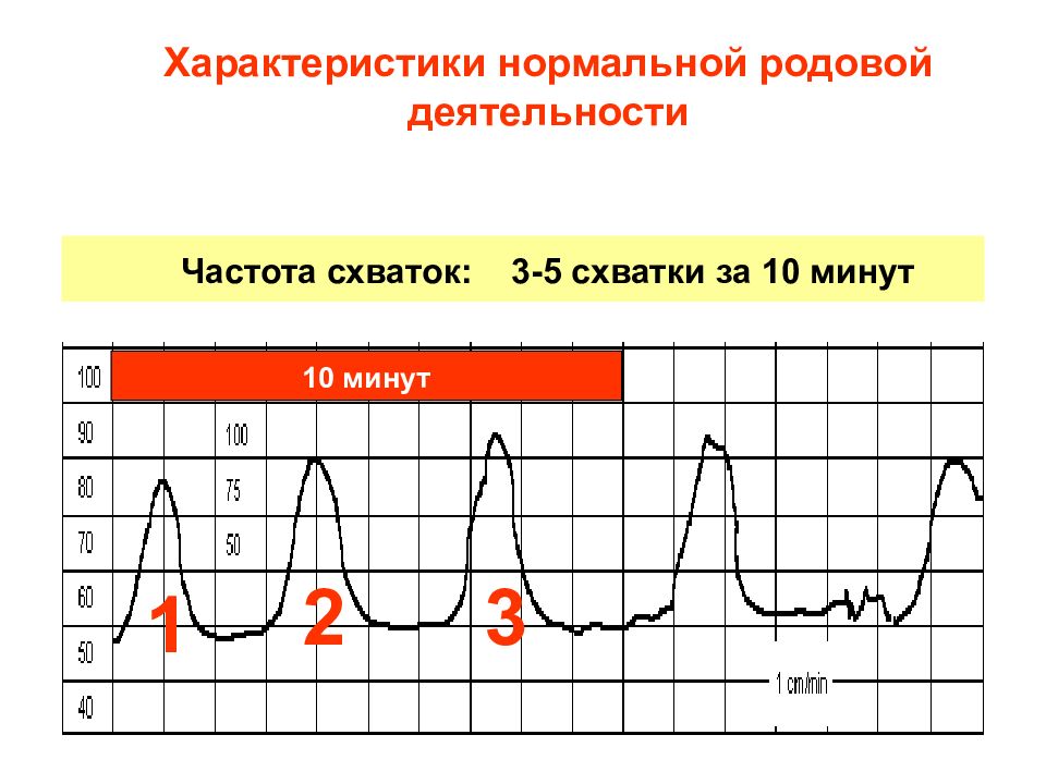 Ктг рисует схватки