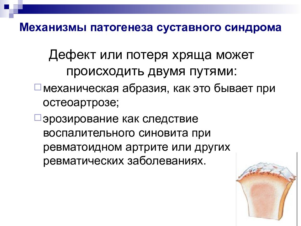 Суставной синдром презентация