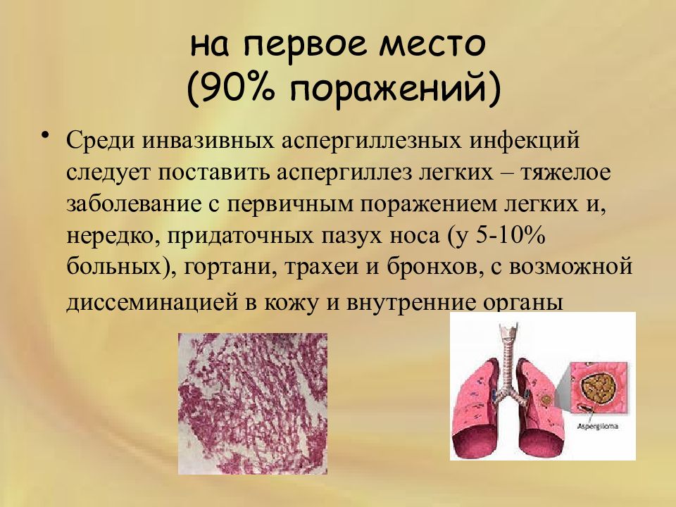 АСПЕРГИЛЛЕЗ — презентация