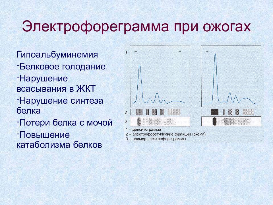 Электрофорез лечение отзывы. Электрофорез. Электрофоретическое Разделение белков. Электрофорез белков.