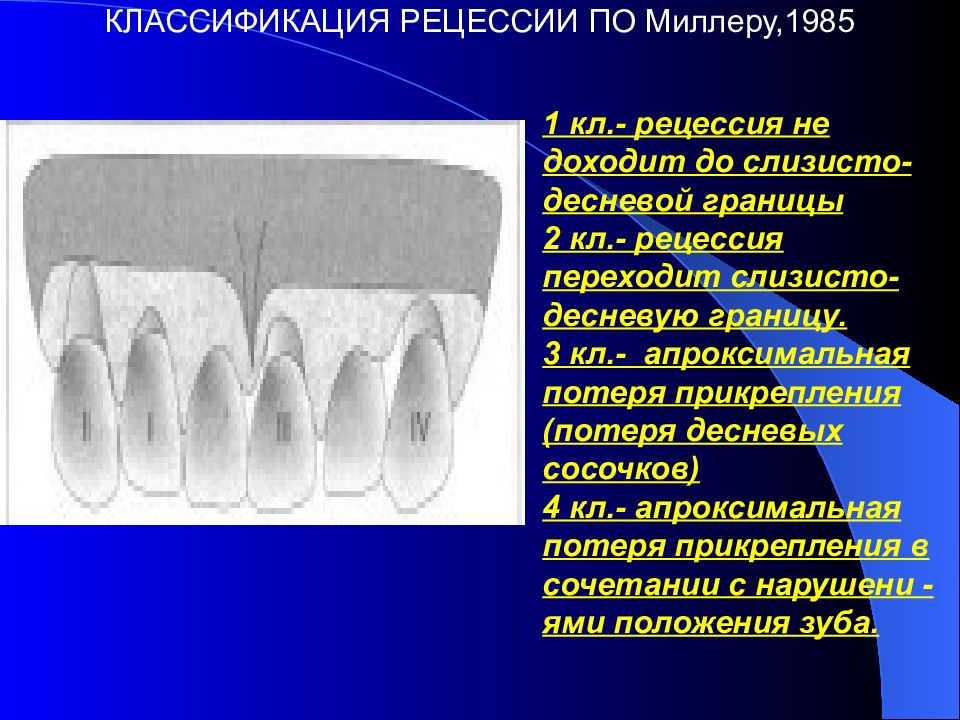 Травматическая окклюзия презентация