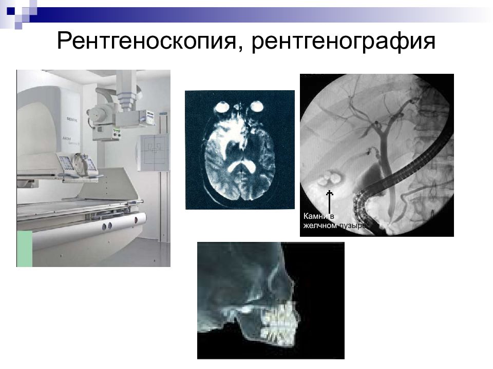 Презентация на тему рентгеноскопия