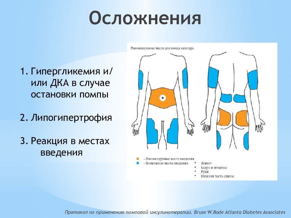 Особенности введения инсулина презентация