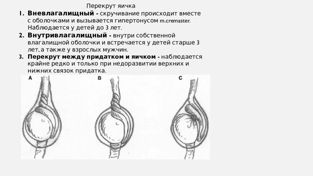 Перекрут яичка карта вызова скорой медицинской помощи