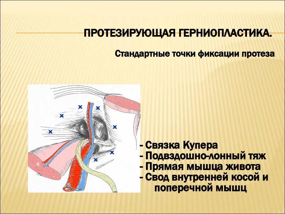 Эмбриональные грыжи презентация