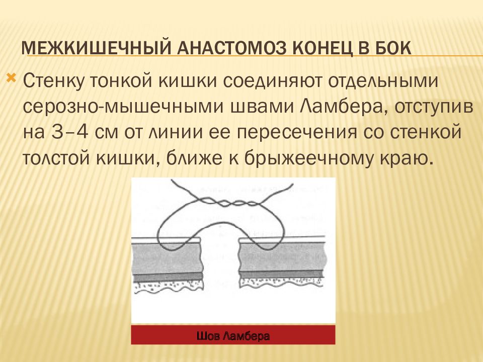 Кишечные анастомозы