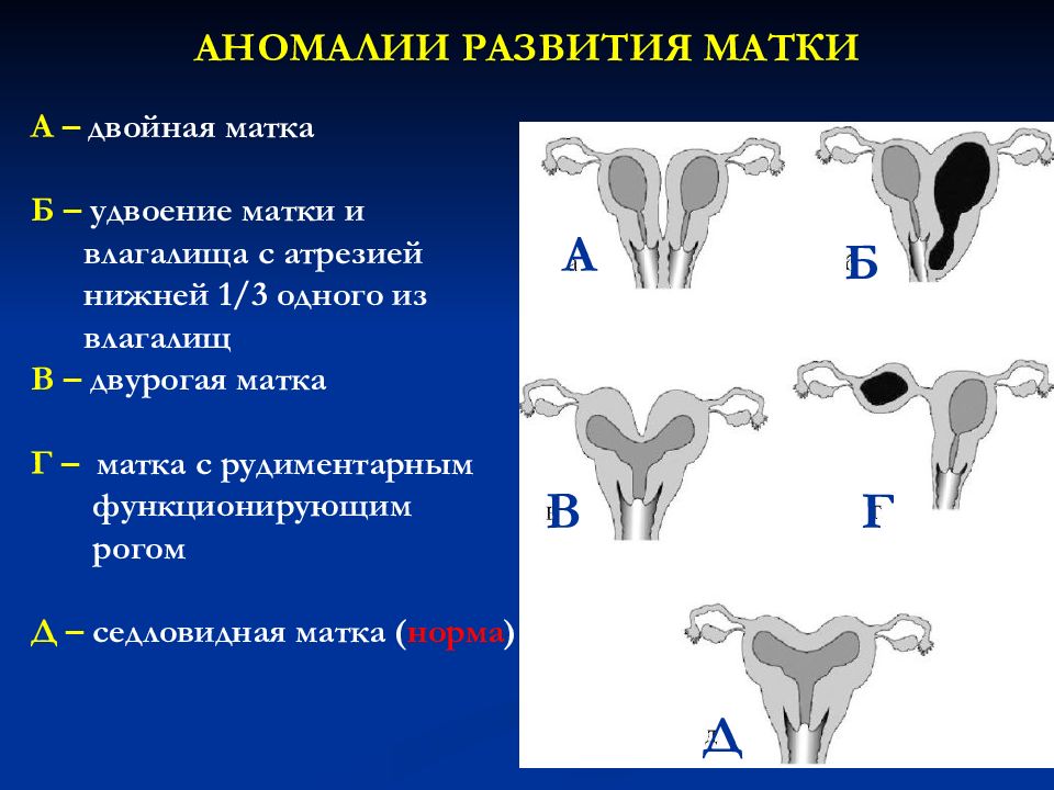 Аномалии развития яичников презентация