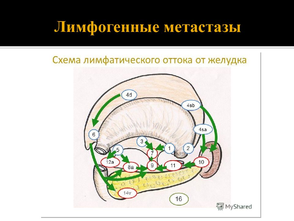 Лимфатические узлы желудка схема