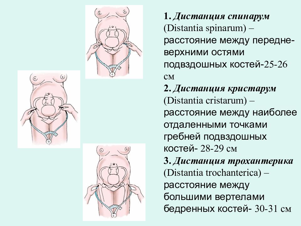 Измерение таза картинки