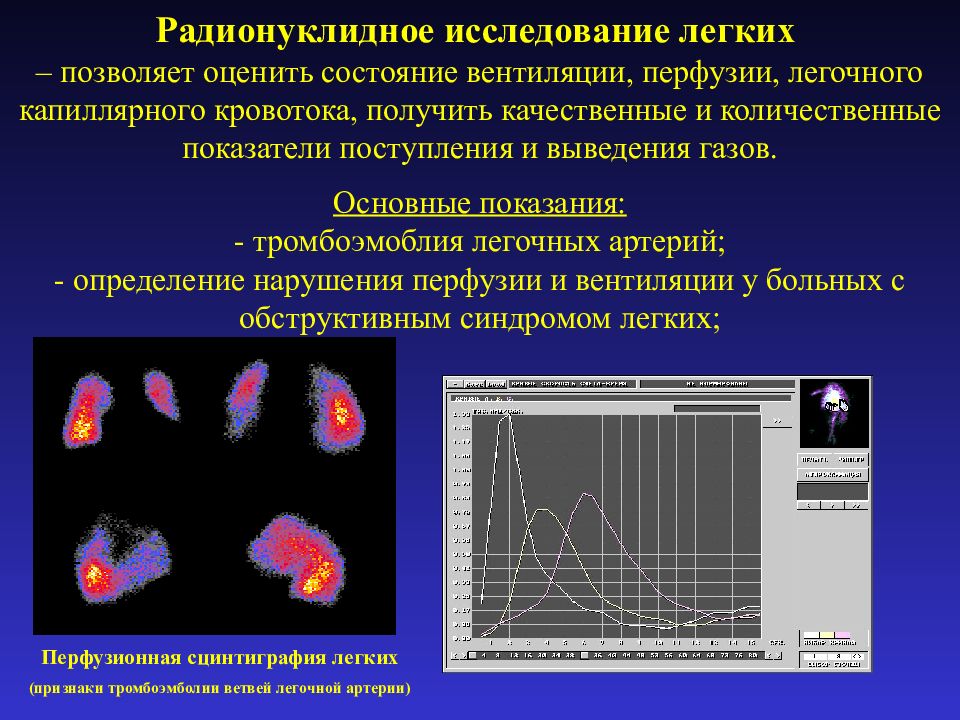 Исследование легких. Радиоизотопное (радионуклидное) исследование легких. Радионуклидный метод исследования легких. Радионуклидные методы исследования органов дыхания.. Радионуклидные, методы обследования больных туберкулезом..