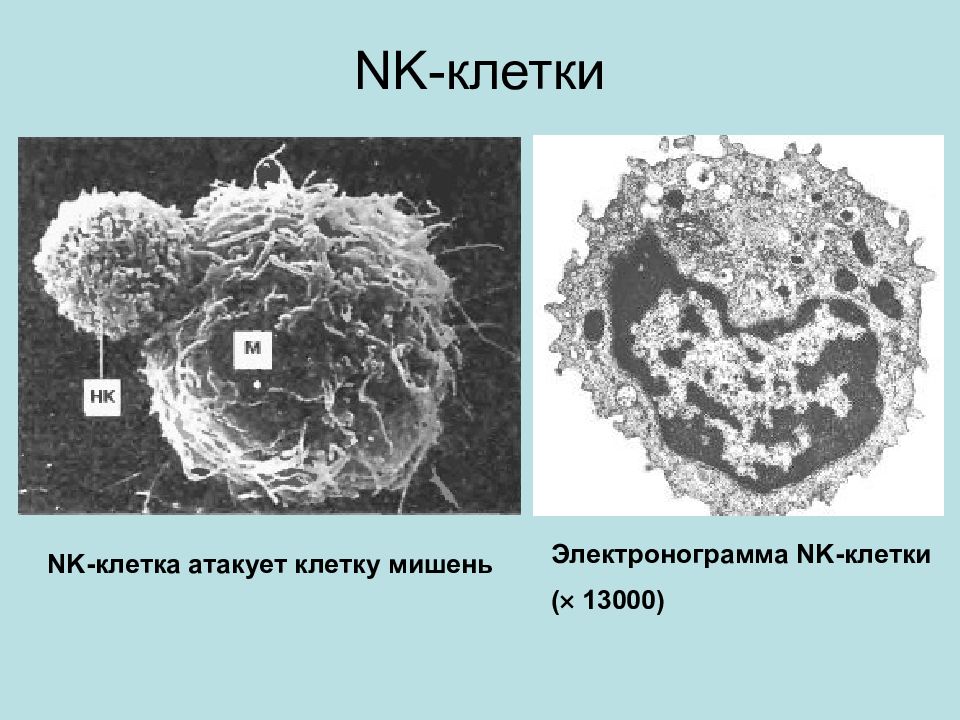 Натуральные клетки. Естественные клетки- киллеры (NK-клетки). NK клетки строение. NK клетки иммунология. НК-клетки (Естественные киллеры) – это.