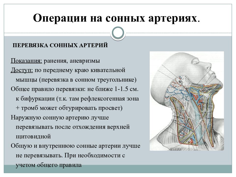 Операция на сонной