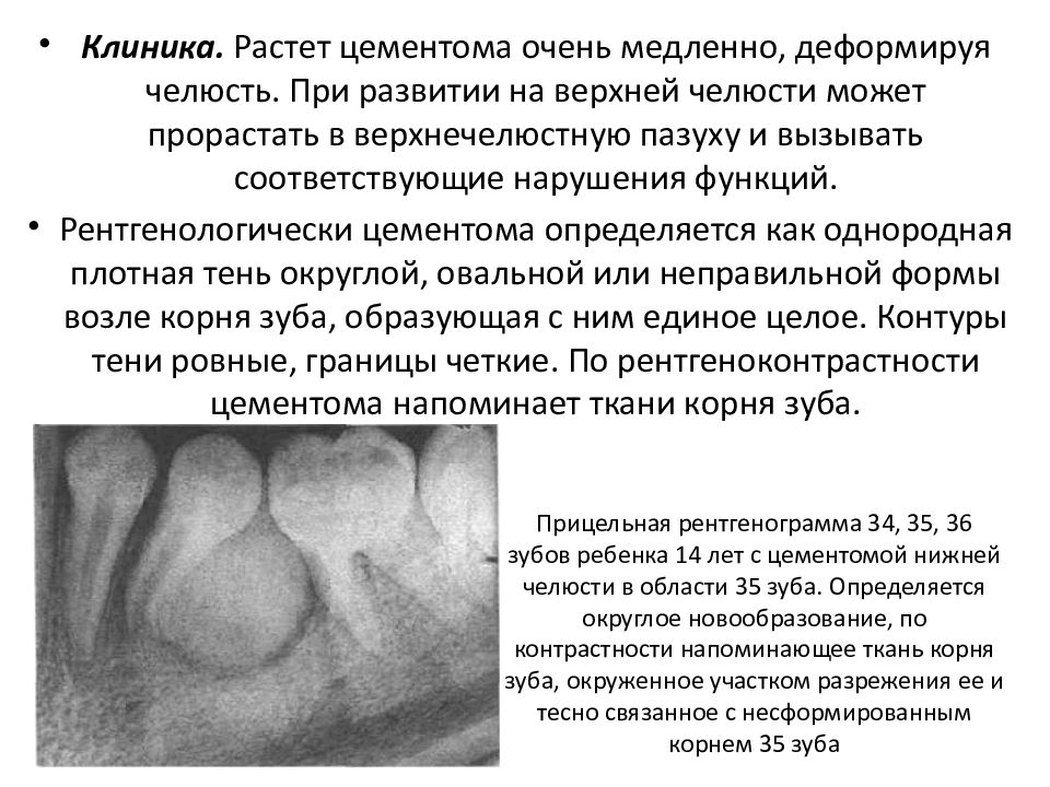 Доброкачественные одонтогенные опухоли челюстей презентация