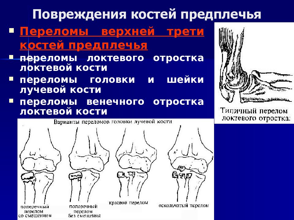 Перелом локтевой кости карта вызова скорой медицинской помощи