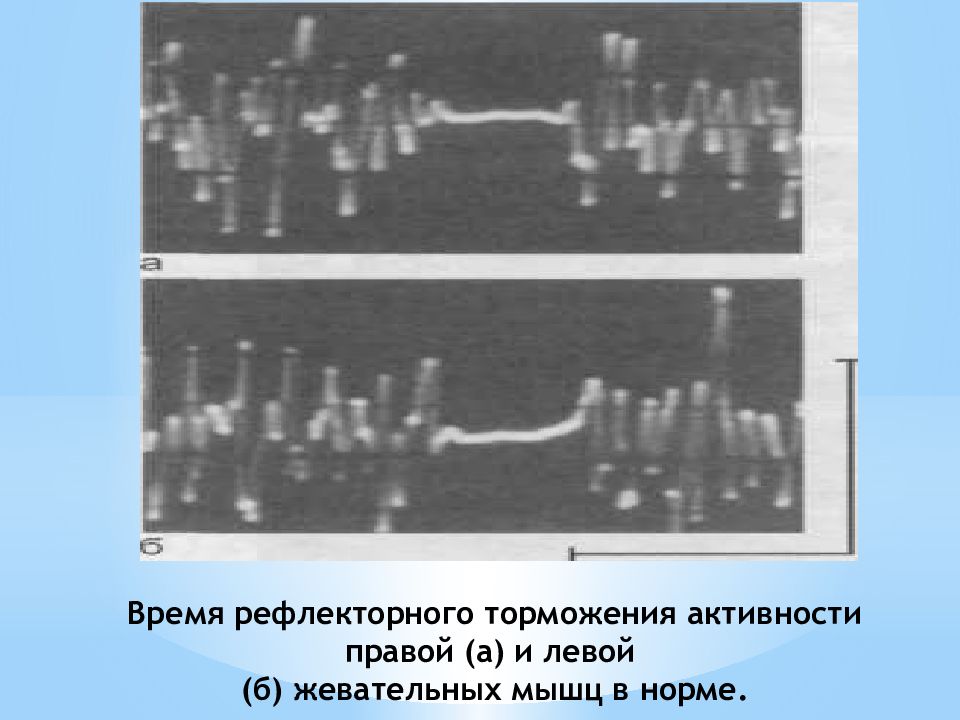 Б левой. Оценка функционального состояния зубочелюстно-лицевой системы.