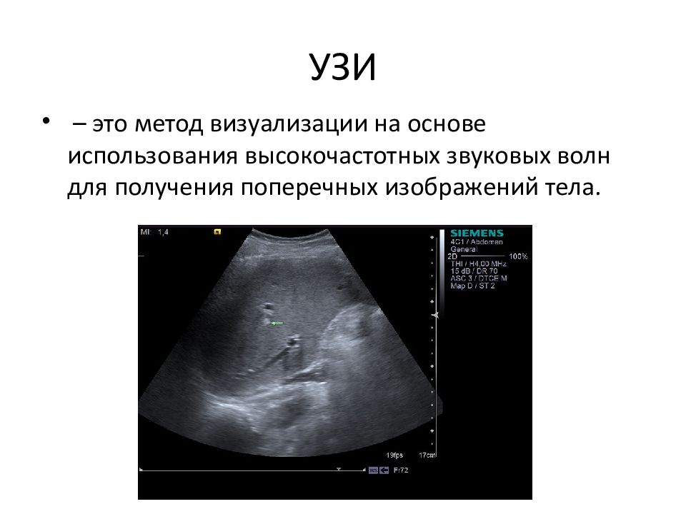 Инструментальные методы исследования в медицине презентация