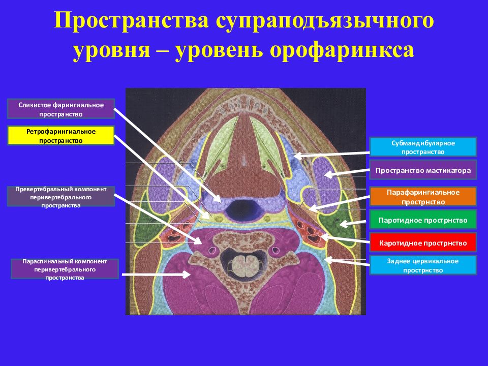 Пространство кт. Клетчаточные пространства шеи кт. Клетчаточные пространства шеи мрт. Пространства шеи анатомия мрт. Пространства шеи кт анатомия.