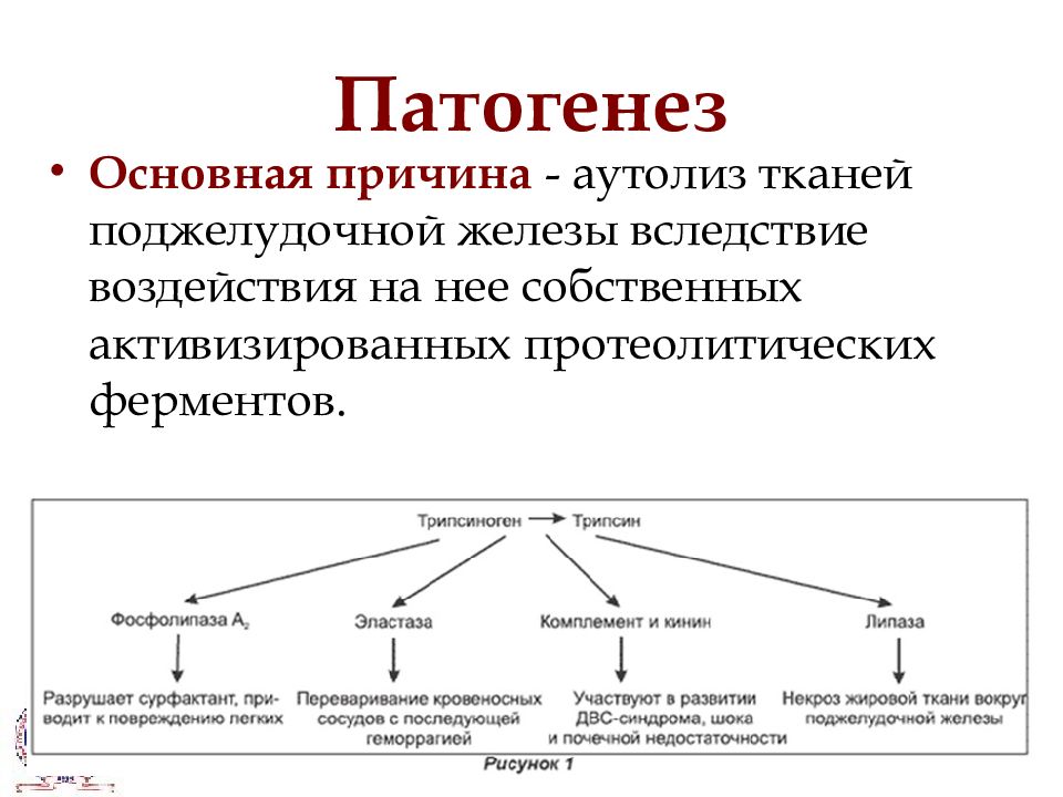 Патогенез. Причины патогенеза. Патогенез поджелудочной железы. Этиология поджелудочной железы.