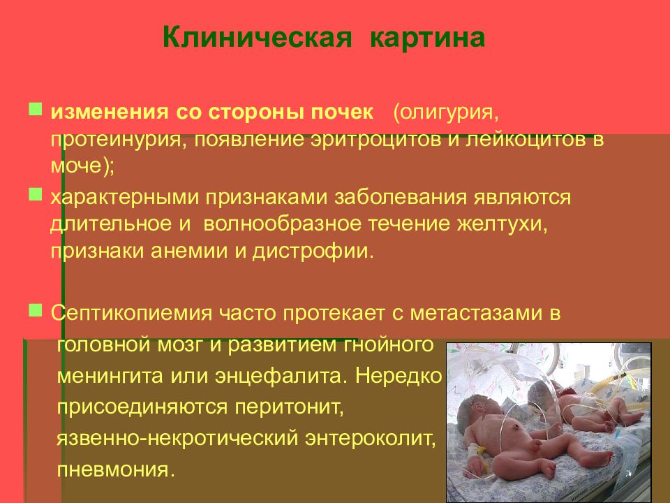 Клиническая картина сепсиса новорожденных