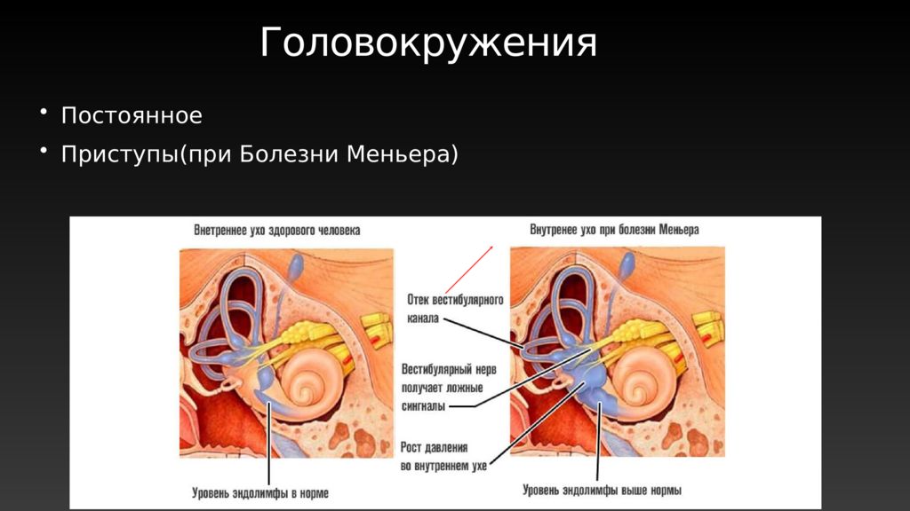 8 пара чмн презентация