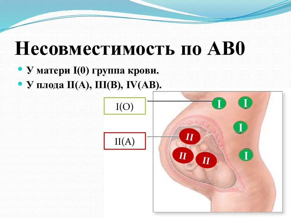 Резус несовместимость матери и плода презентация