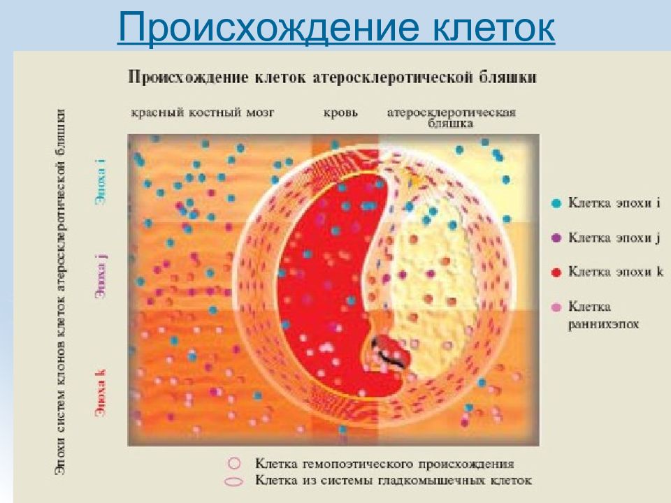 Откуда клетки. Клеточный компонент атеросклеротической бляшки. Состав атеросклеротической бляшки. Строение атеросклеротической бляшки патанатомия. Из чего состоит атеросклеротическая бляшка.