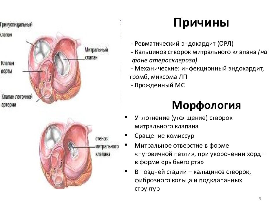 Какой цифрой на рисунке обозначен митральный клапан