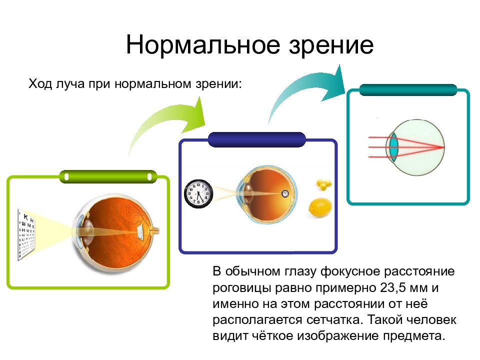 Формирование изображения в нормальном глазе