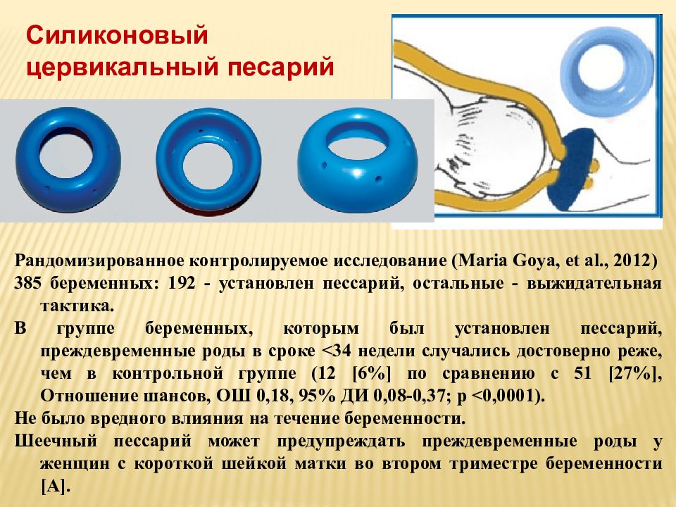 Пессарий Размеры. Рекомендации при пессарии. Виды пессариев. Пессарии типы распределение размеров.