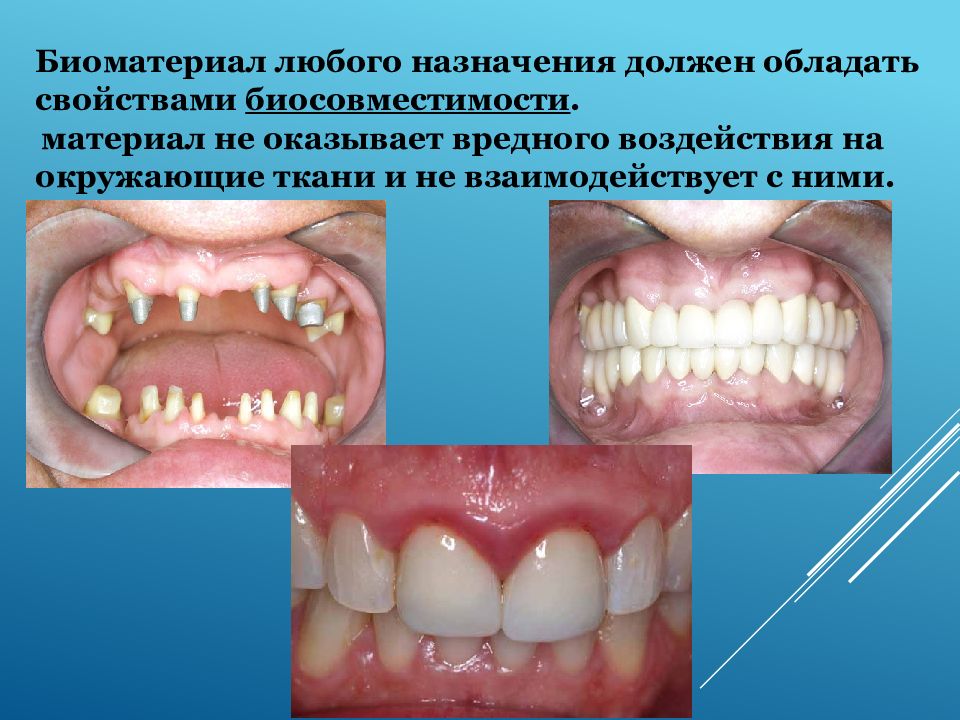 Принципы контроля качества стоматологических материалов