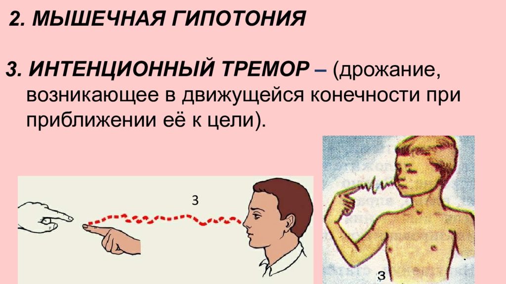 Пропедевтика нервных болезней презентация