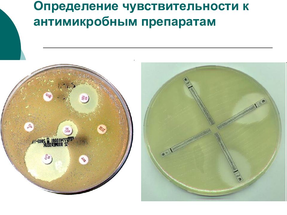 Микробиологический препарат определение. Чувствительность бактерий к антибактериальным препаратам. Определение чувствительности микроорганизмов к антибиотикам. Чувствительность микробов к антибиотикам определяется. Чувствительность к антибиотикам микробиология.