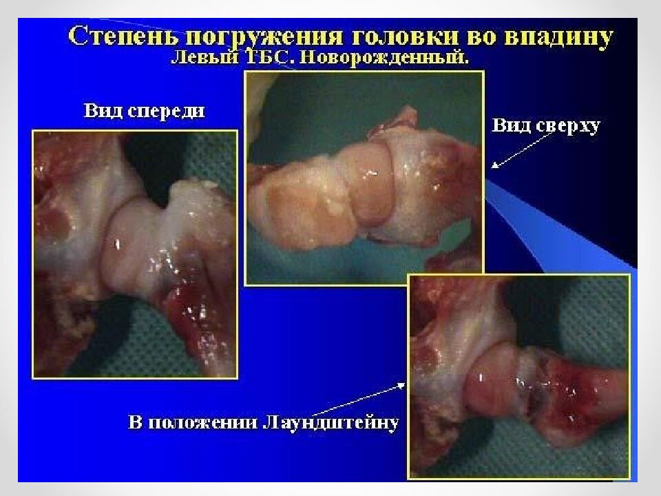 Ростовский государственный медицинский университет Кафедра детской хирургии и