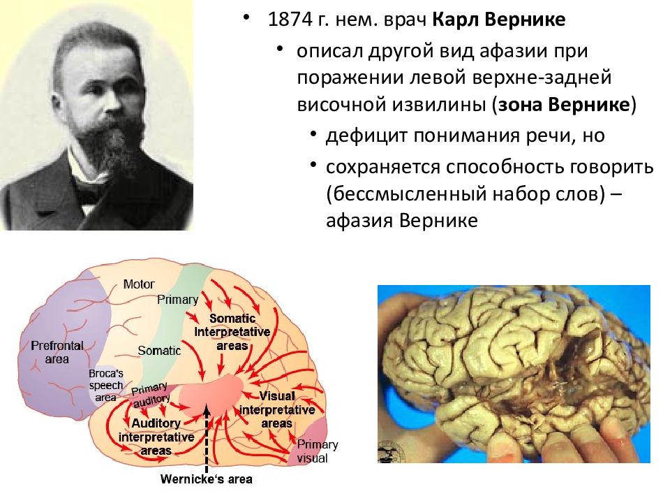 Речь и мозг. Карл Вернике мозг. Карл Вернике центр речи. Карл Вернике вклад в нейропсихологию. Немецкий ученый Вернике.