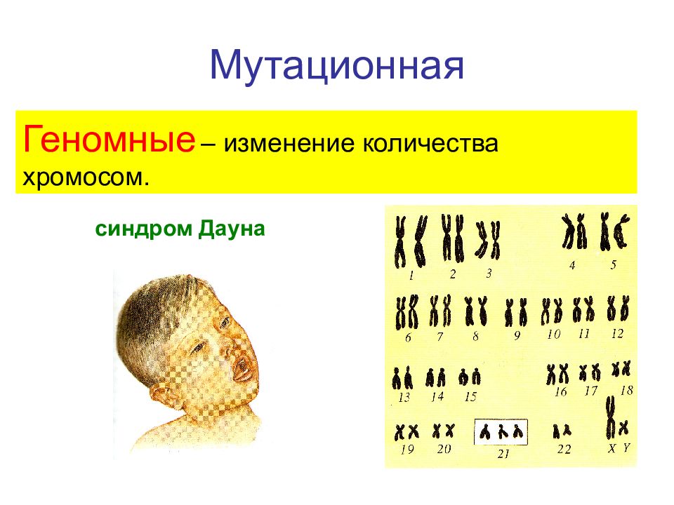 Форма изменчивости дауна. Синдром Дауна колво хромосом. Мутационная изменчивость синдром Дауна. Колько хромосом у человека. 46 Хромосом.