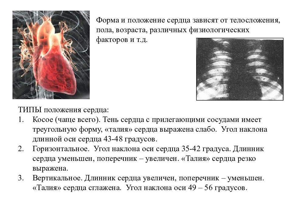 При смене положения сердце. Форма и положение сердца. Типы положения сердца. Косое положение сердца. Варианты расположения сердца.