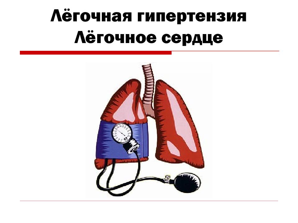 Лёгочная гипертензия Лёгочное сердце