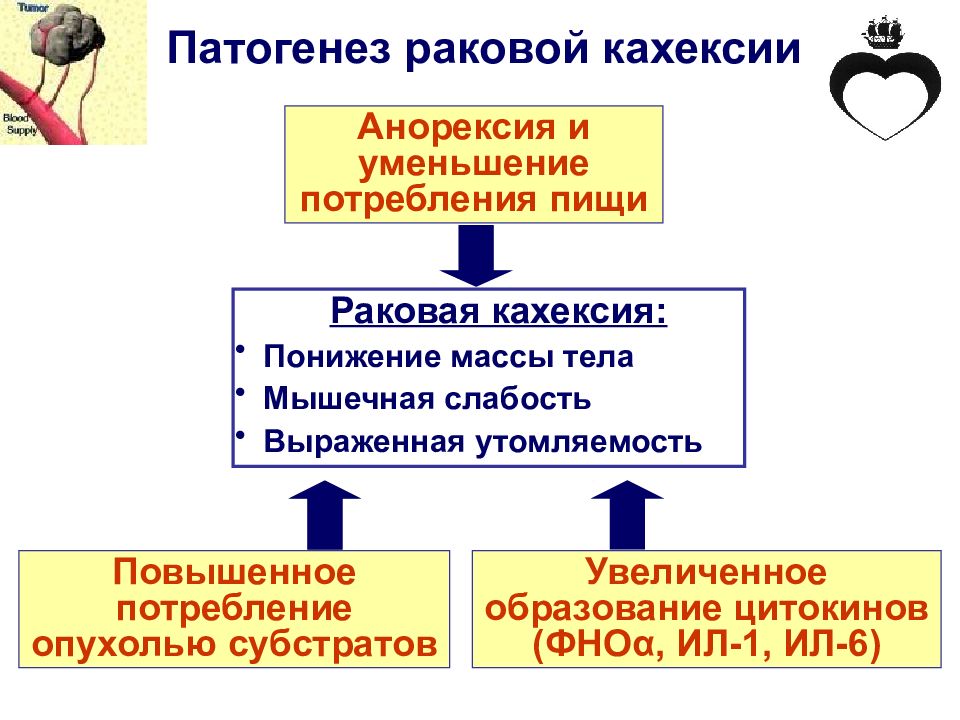 Схема патогенеза раковой кахексии патофизиология